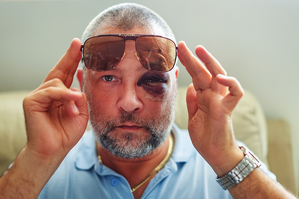 Naples assault and battery lawyer advising client on legal options after being injured in an attack.